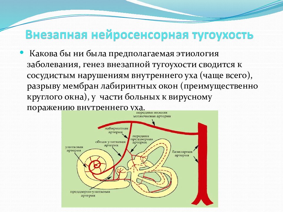 Нейросенсорная тугоухость