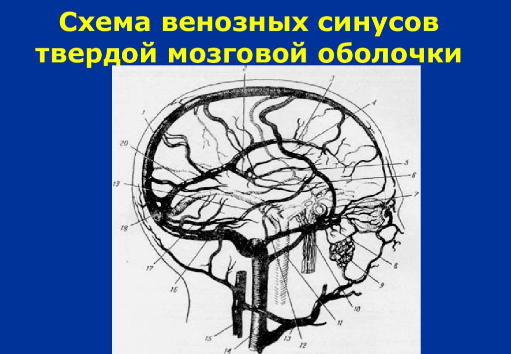 Синусы оболочки головного мозга. Схема венозных синусов твердой мозговой оболочки. Вены головного мозга синусы твердой мозговой оболочки. Венозные синусы головного мозга анатомия. Хирургическая анатомия синусов твердой мозговой оболочки.