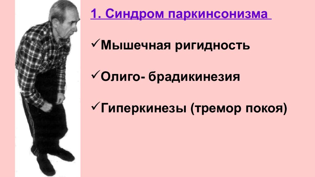 Пропедевтика нервных болезней презентация