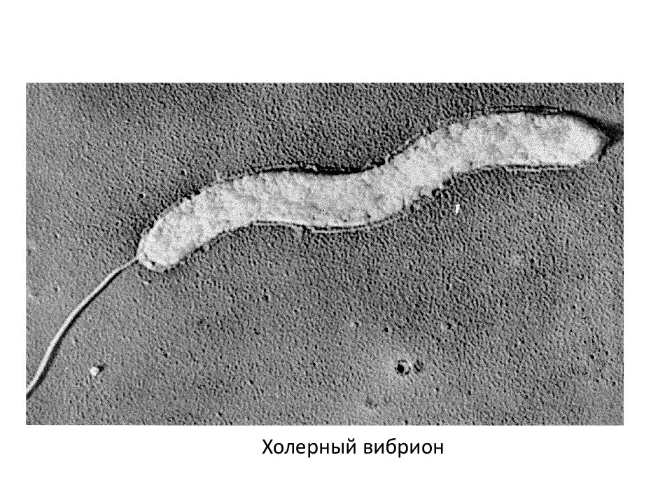 Холерный вибрион фото под микроскопом