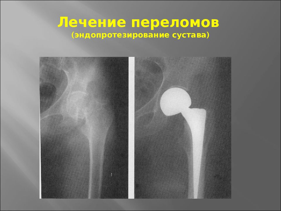 Основы травматологии презентация