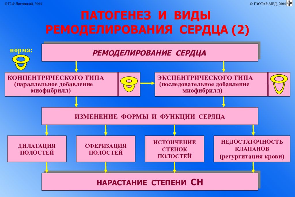 Аритмии патофизиология презентация