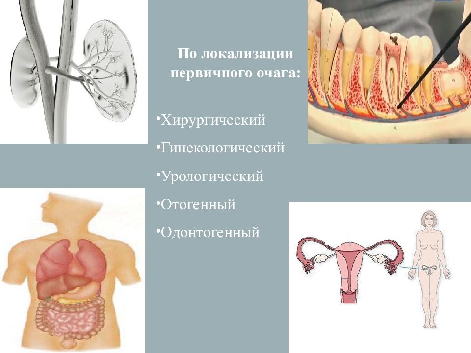 Патофизиология инфекционного процесса презентация