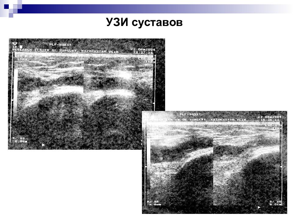 Узи суставов ярославль