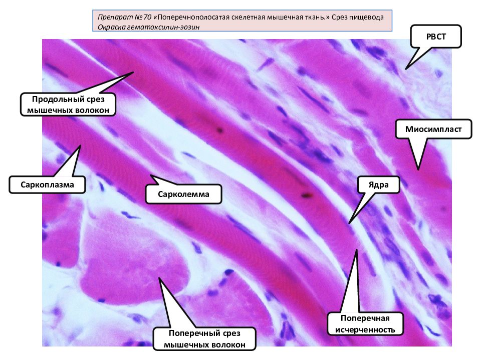 Скелетная мышечная ткань гистология рисунок