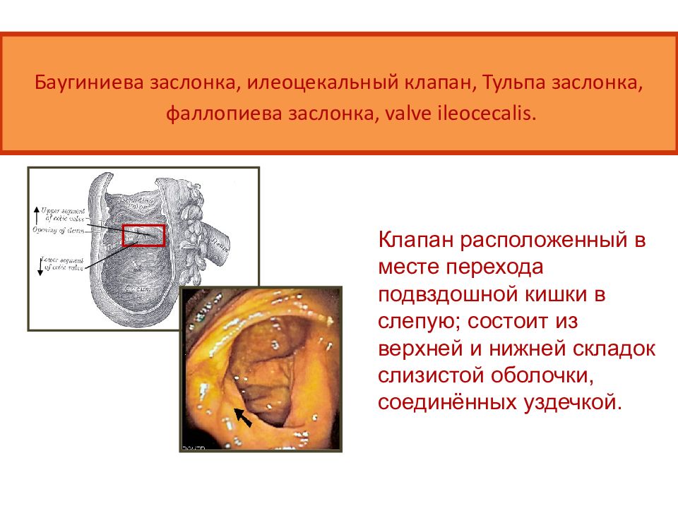 Баугиниевая заслонка где находится в кишечнике картинки