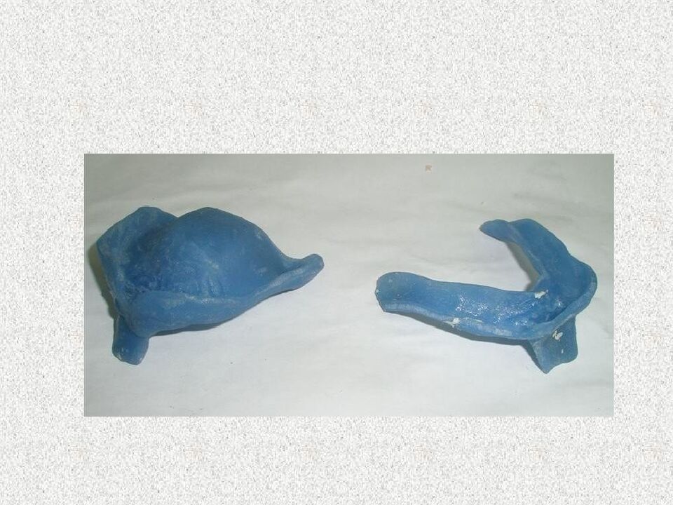 Funksional otisklar uchun individual qoshiqchalar