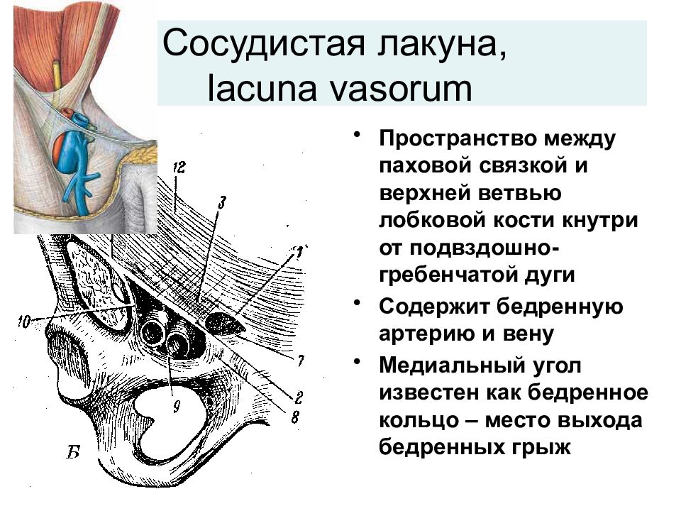 Сосудистая лакуна