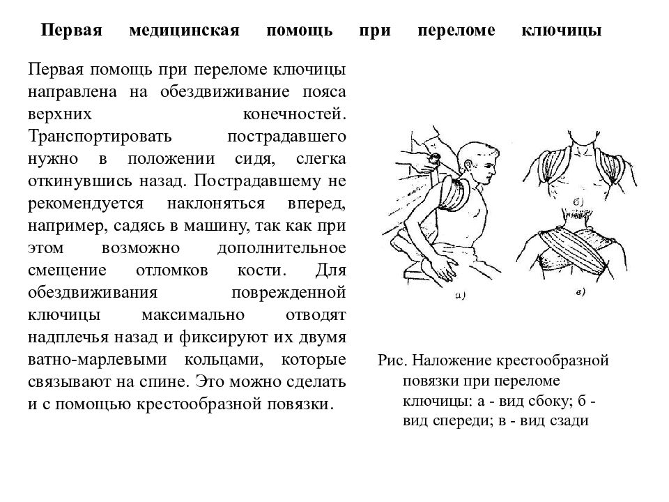 Перелом ключицы первая помощь. Перелом ключицы первая доврачебная помощь. Перелом ключицы первая помощь алгоритм. Травма ключицы первая помощь. Алгоритм оказания первой медицинской помощи при переломе ключицы.