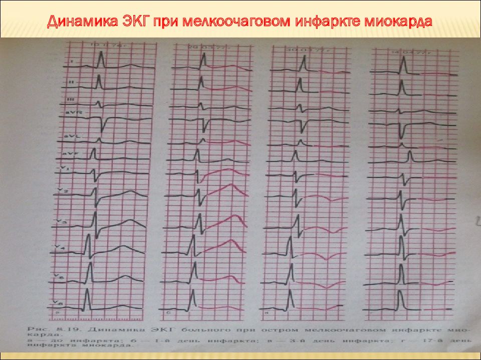 Экг в динамике что это