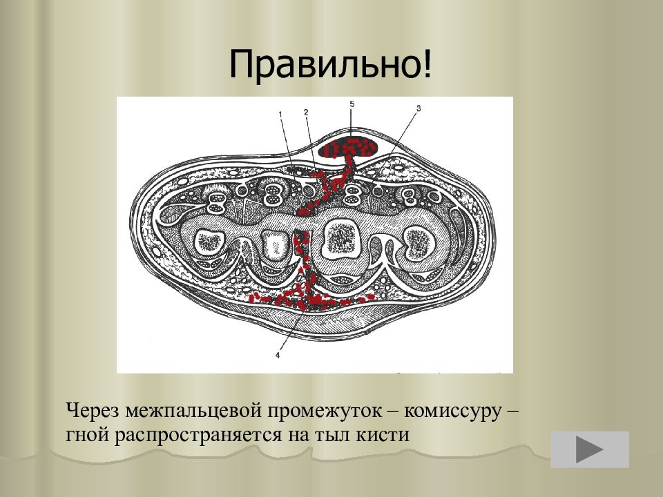 Через правильно