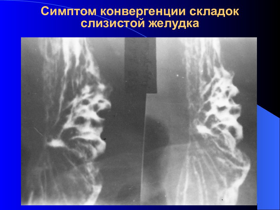 Лучевая диагностика заболеваний жкт презентация