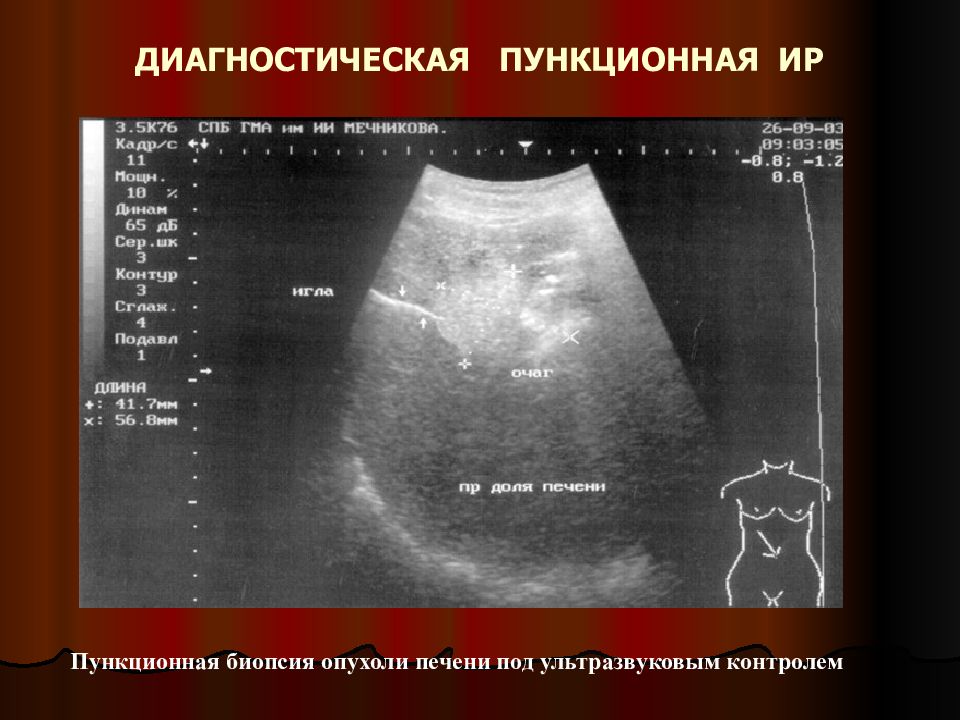 Интервенционная радиология презентация