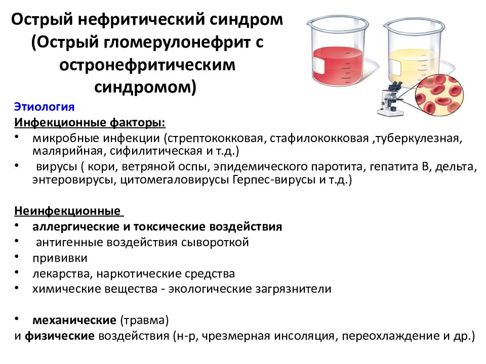 Клиническая картина нефритический синдром