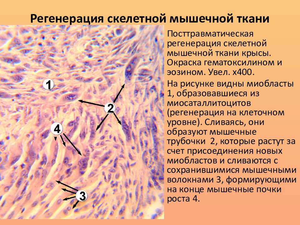 1 регенерация. Регенерация мышечной ткани гистология. Регенерация гладкой и поперечно-полосатой мышечных тканей. Регенерация гладких миоцитов. Регенерация поперечно-полосатой мышечной ткани гистология.