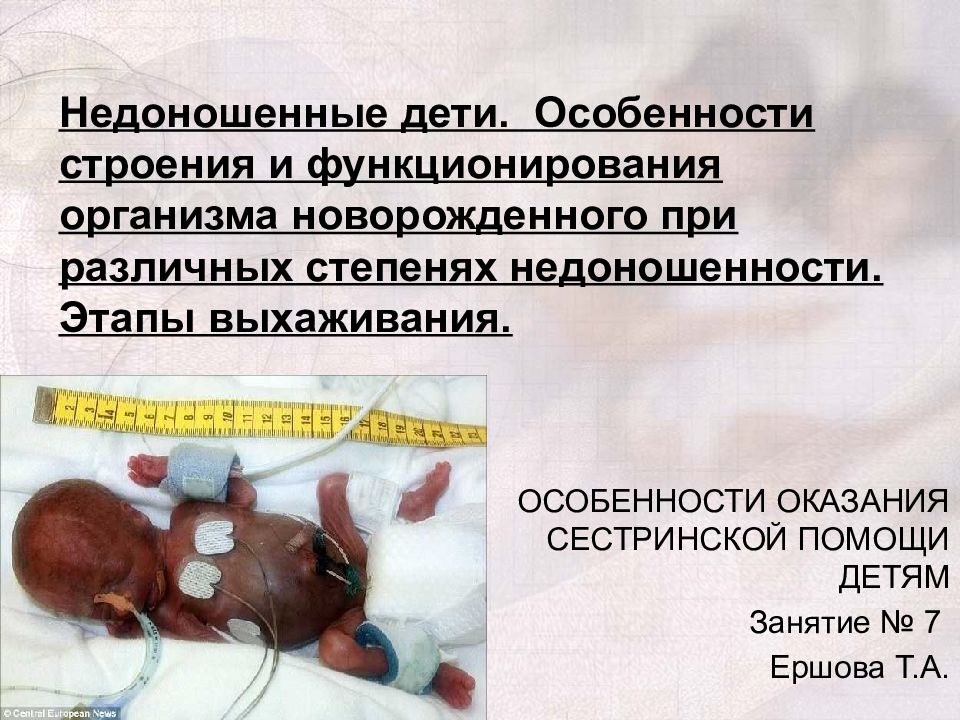 Недоношенные дети. Особенности строения и функционирования организма новорожденного при различных степенях недоношенности. Этапы выхаживания.