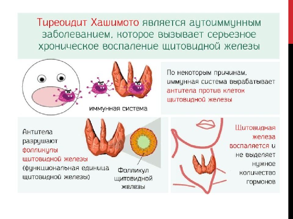 Alimentacion tiroiditis de hashimoto