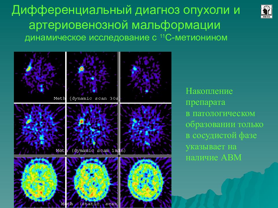 Позитронно эмиссионная томография презентация