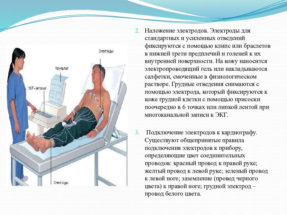 Экг наложение электродов схема по цветам фото и описание