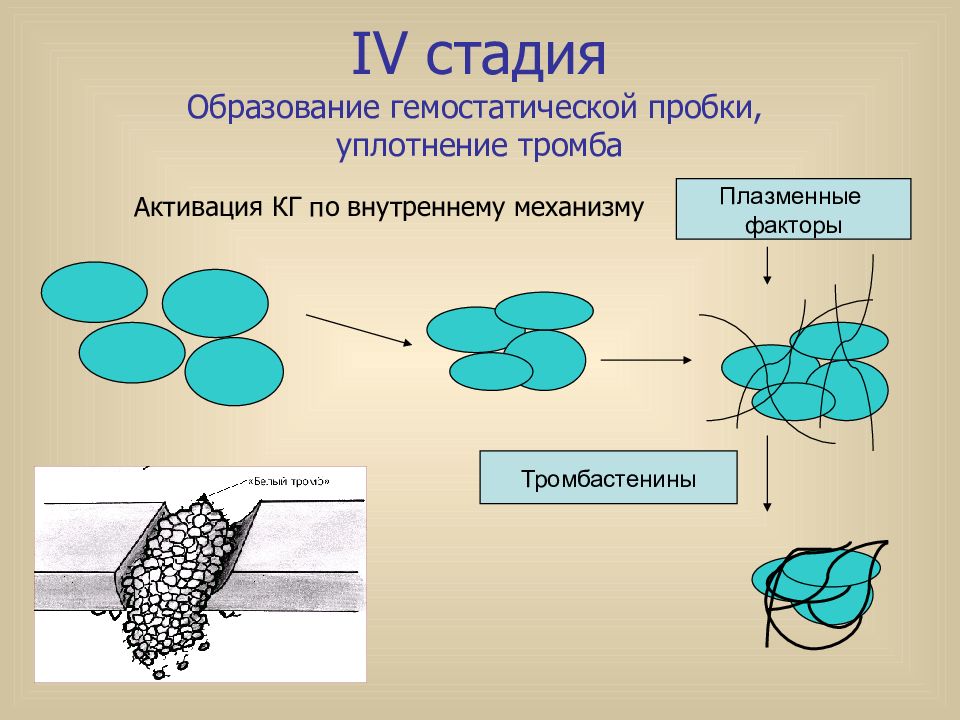 4 этапы образовании. Этапы образования тромба. Механизм образования белого тромба. Стадии образования. Механизм образования белого тромба связан с.