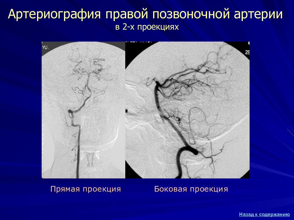 Почечная ангиография презентация