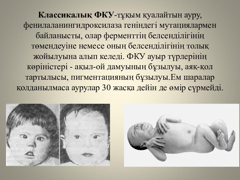 Жеке аминқышқылдардың алмасуы және оның бұзылуының биохимиялық негіздері Жеке аминқышқылдардың алмасуы және оның бұзылуының биохимиялық негіздері