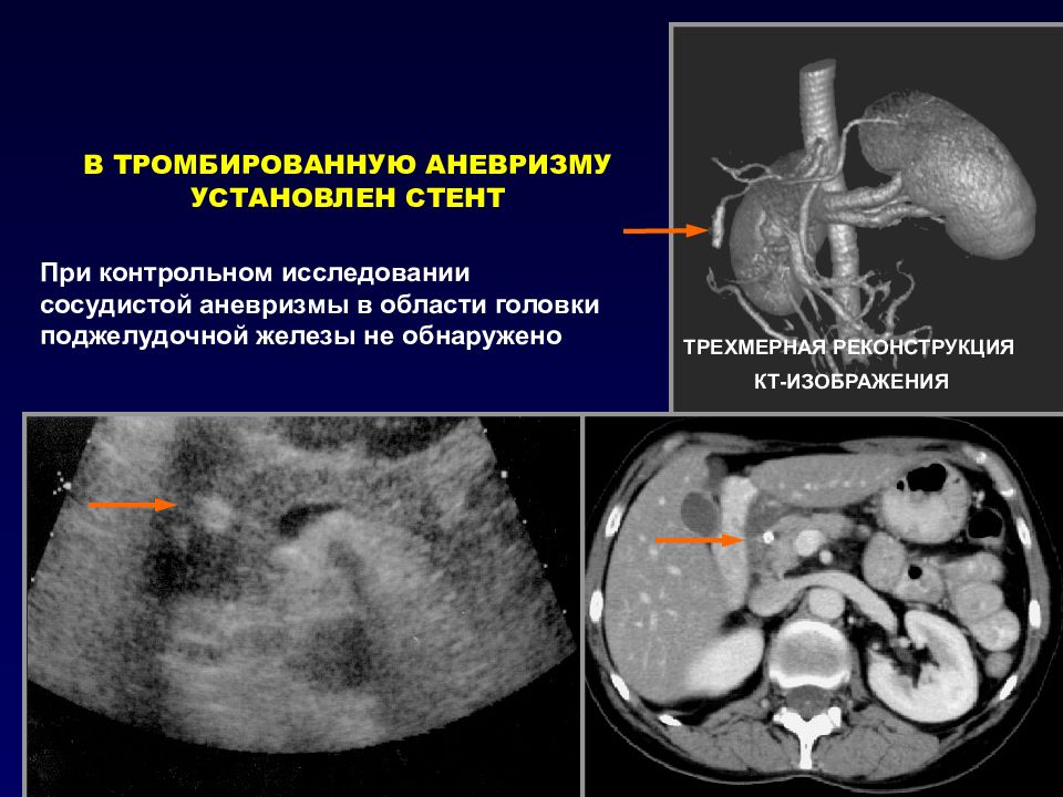 Реконструкция изображений в компьютерной томографии