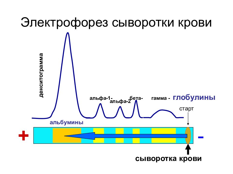 Электрофорез белков. Электрофорез белков сыворотки крови. Разделение белковых фракций крови методом электрофореза. Электрофорез белков сыворотки крови (белковые фракции). Электрофорез белков сыворотки крови принцип метода.