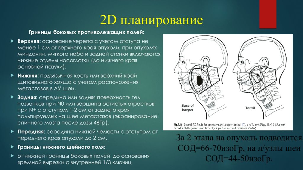 Планирование лучевой терапии презентация