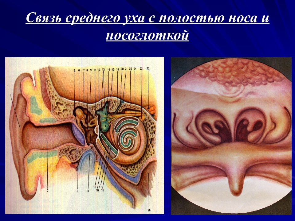 Полость связывать. Отосклероз и тугоухость. Евстахиева труба и носоглотка. Ушная раковина тугоухость.