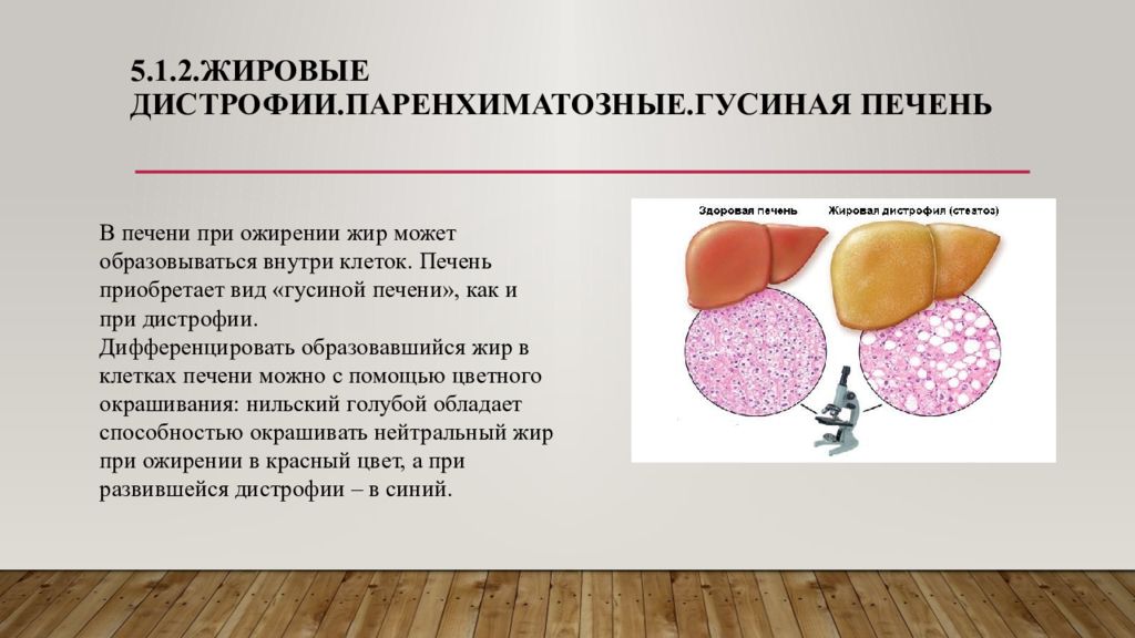 Опухоль с преобладанием паренхиматозной ткани на ощупь