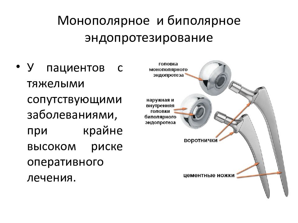 Презентация эндопротезирование плечевого сустава