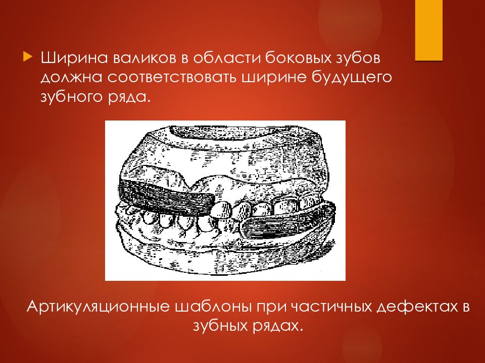 Определение центрального соотношения челюстей при полном отсутствии зубов презентация