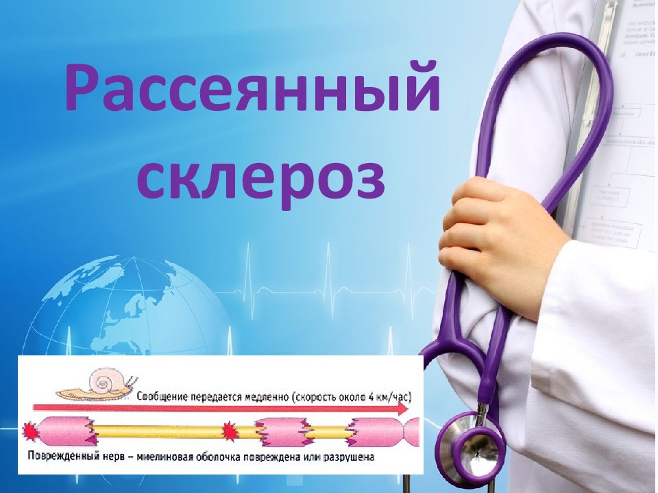 Презентация на тему рассеянный склероз