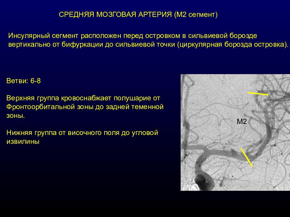 Ветви задней мозговой артерии. Среднемозговая артерия м2 сегмент. Ветви м2 сегмента средней мозговой артерии. М2 сегмент средней мозговой артерии. М1 и м1 сегменты средней мозговой артерии.