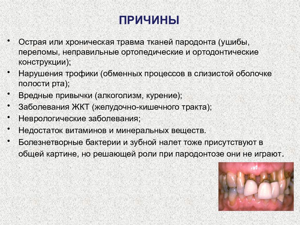 Признаки лечения зубов. Острый генерализованный катаральный гингивит. Болезни пародонта гингивит пародонтит пародонтоз. Катаральный гингивит хронич. Хронический гингивит этиология патогенез.