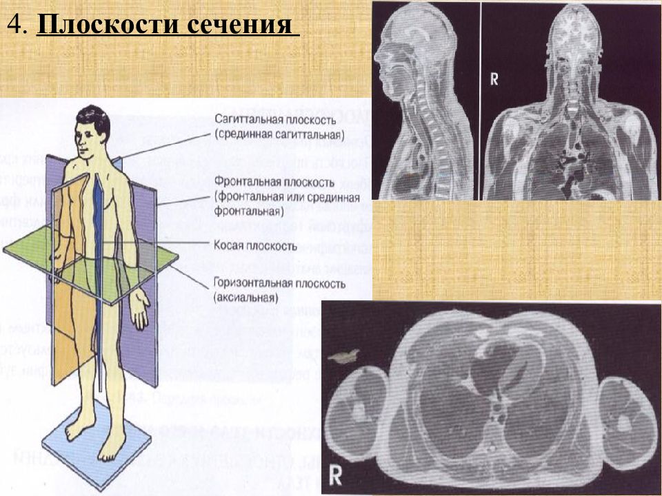 Введение в лучевую диагностику презентация