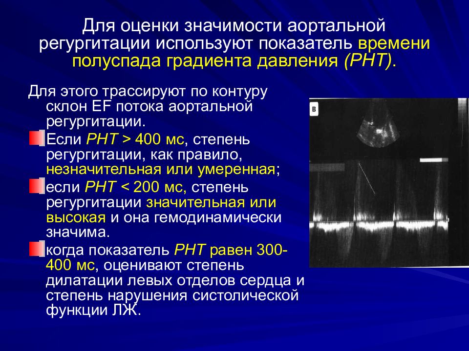 Аортальная недостаточность ЭХОКГ PHT. Аортальная регургитация степени ЭХОКГ. Оценка аортальной регургитации при ЭХОКГ. Регургитация аортального клапана классификация.