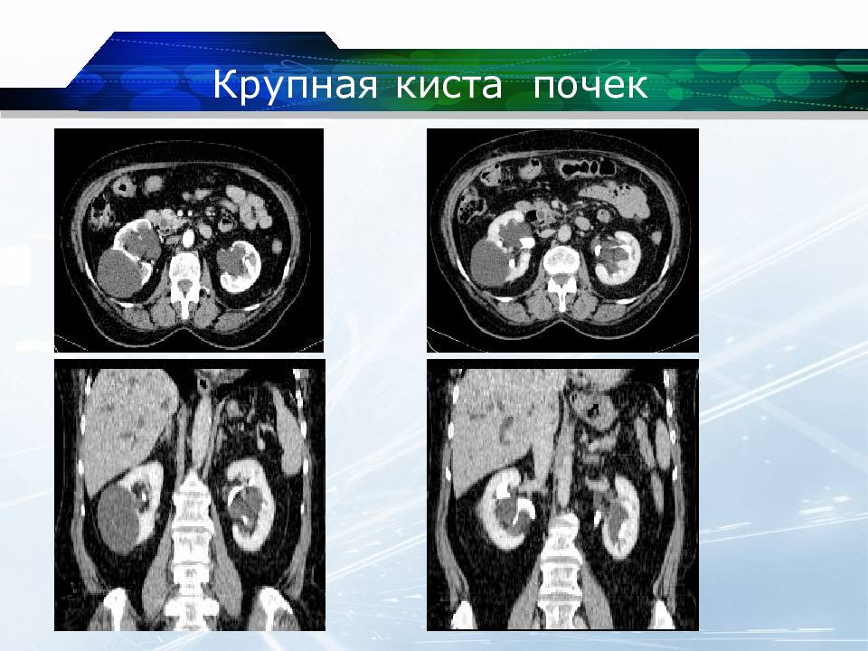 Кт почек презентация