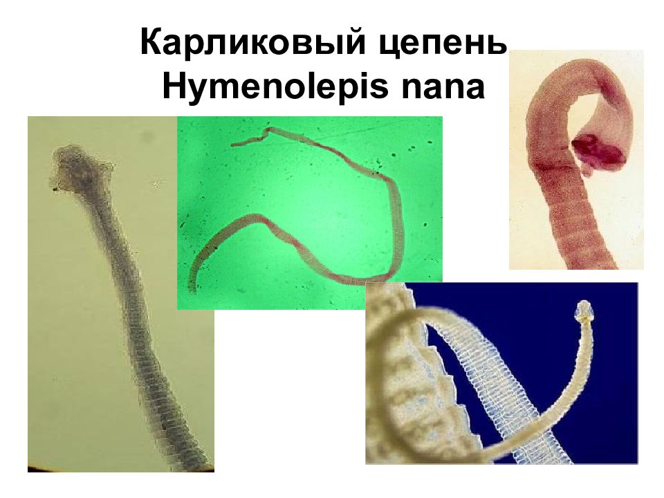 Карликовый цепень строение. Карликовый цепень (Hymenolepis Nana). Класс ленточные черви карликовый цепень. Ленточные черви паразиты карликовый цепень. Гименолепидоз карликовый цепень.