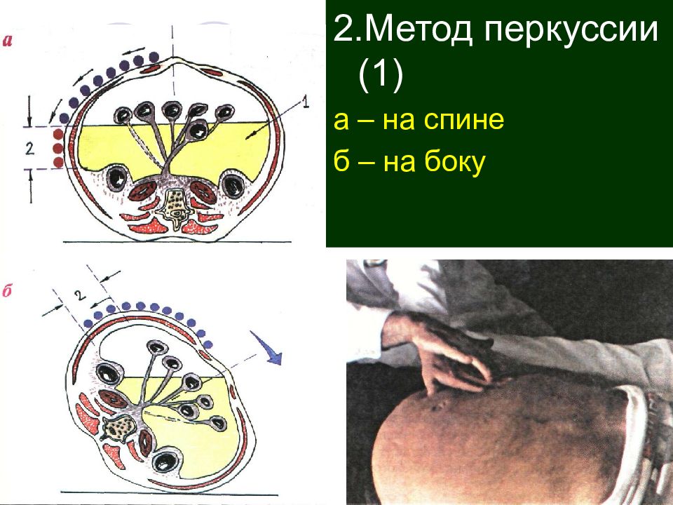 Методы изучения органов пищеварения биология. Перкуссия органов пищеварения. Методика обследование органов пищеварения перкуссия. Метод проведение перкуссия пищеварительной системы. 2. Метод перкуссии..