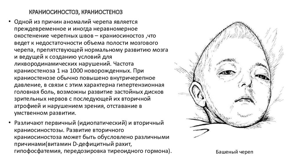 Врожденные аномалии костей черепа нмо ответы