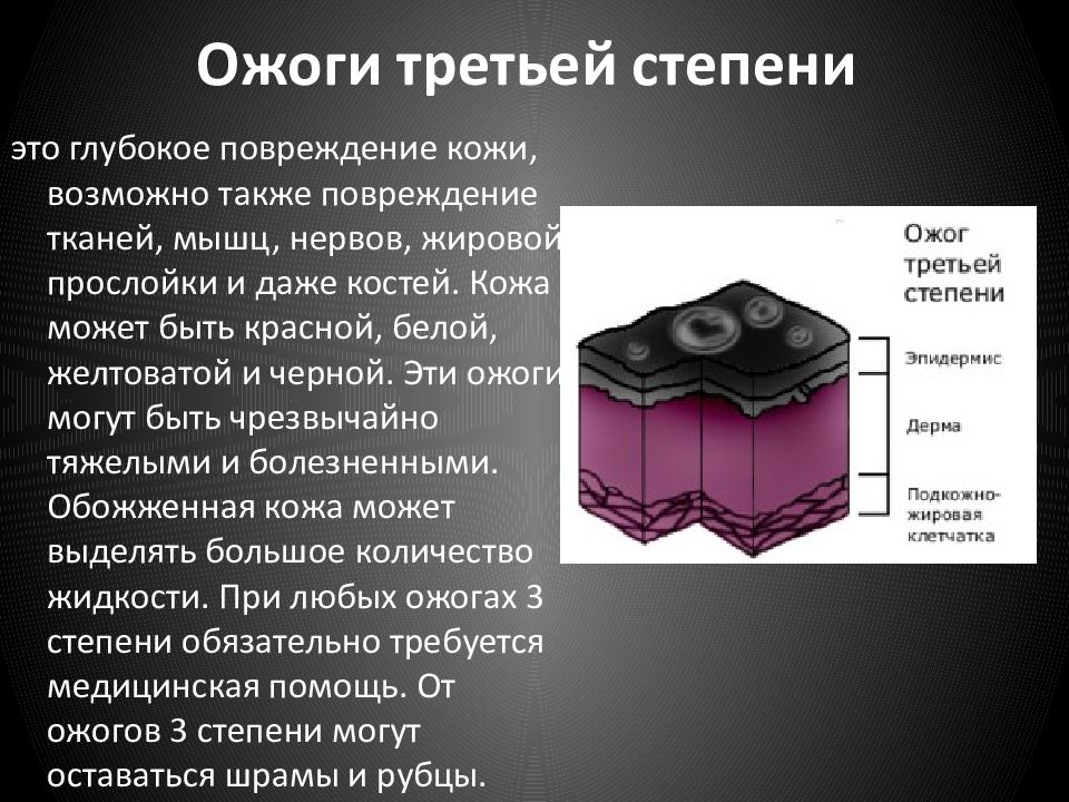 Третья стадия. Степени ожогов 3 степени.