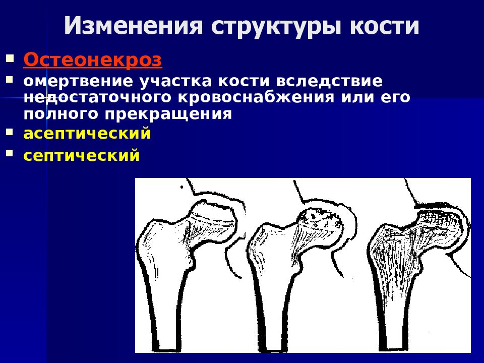 Кости и суставы. Болезнь костей и суставов название. Рентгеносемиотика изменений костей и суставов.