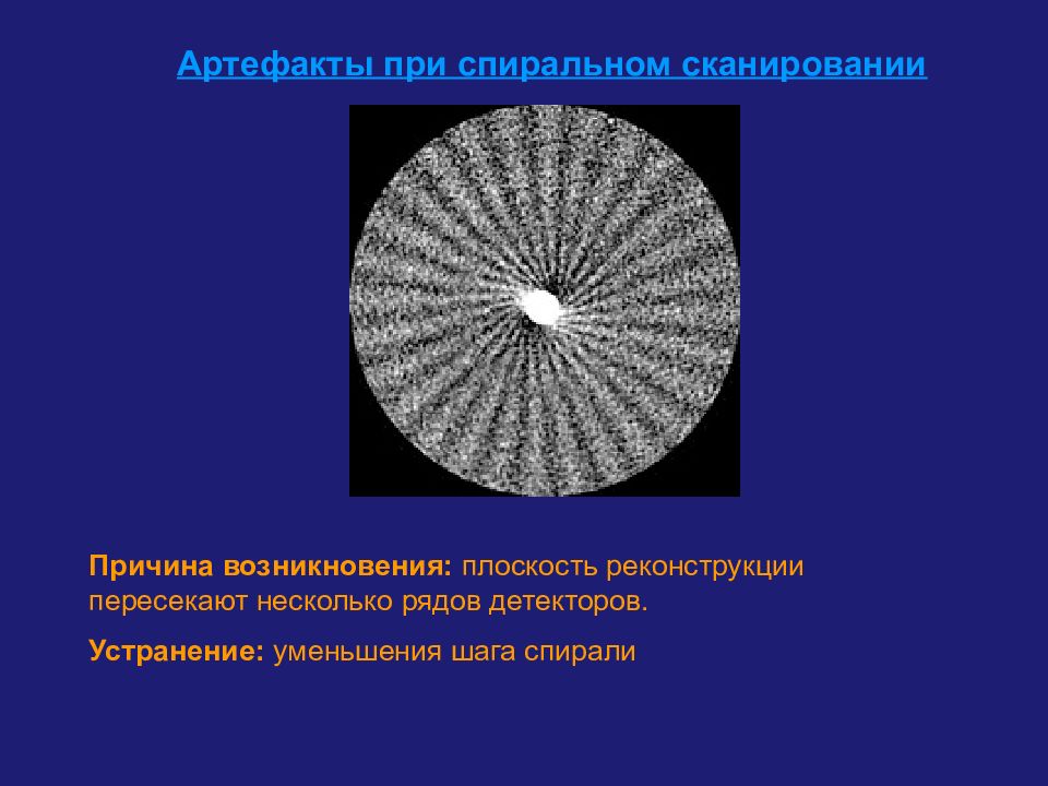 Артефакты кт изображений