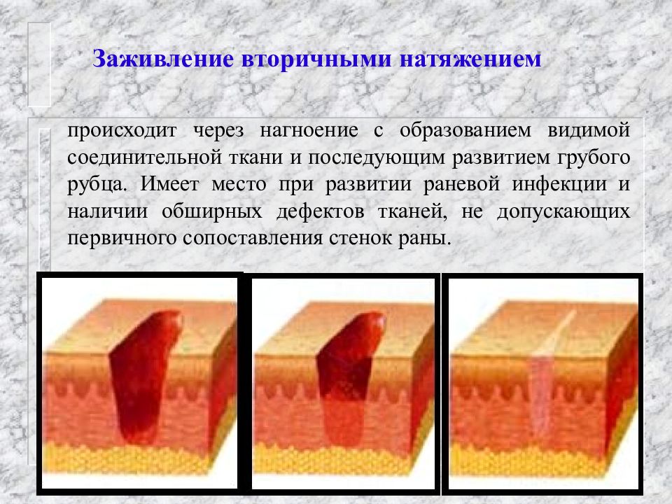 Заживление ран картинки