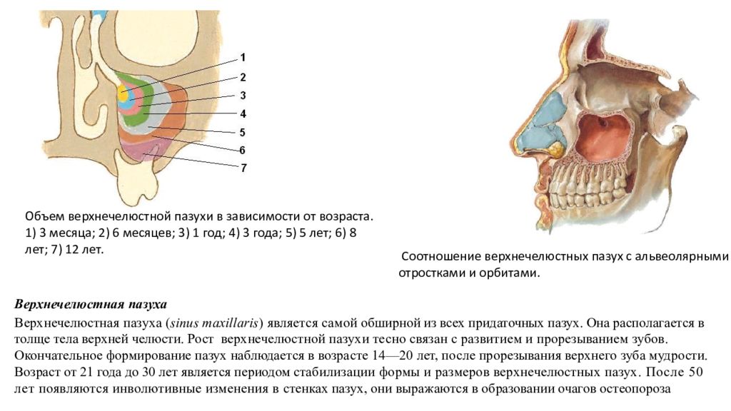 Правая пазуха. Стенки гайморовой пазухи анатомия. Верхнечелюстная пазуха анатомия строение. Стенки верхнечелюстной пазухи. Стенки гайморовой пазухи анатомия на кт.