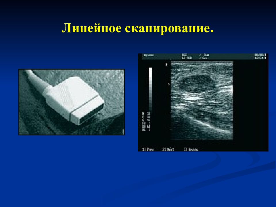Презентация на тему ультразвуковые методы исследования
