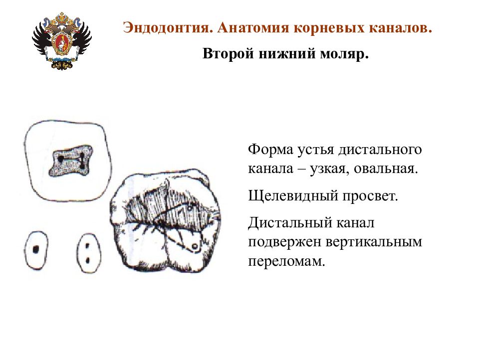 Анатомия каналов. Топография устьев корневых каналов Нижний моляр. Название каналов нижних моляров. Анатомия каналов нижних моляров. Нижний 2 моляр корневые каналы.