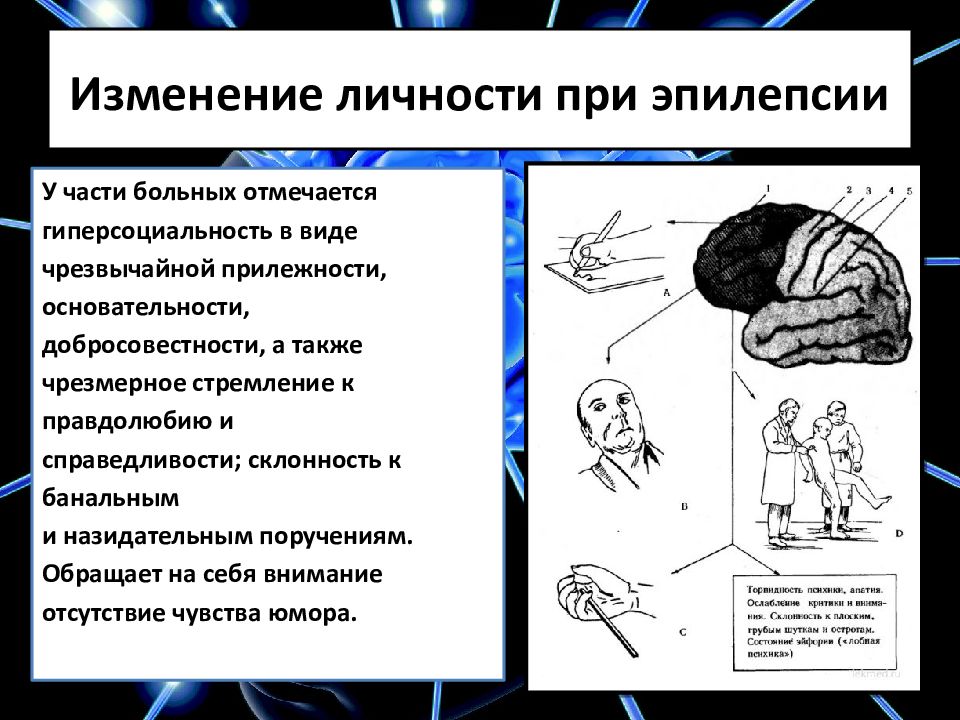 Психические расстройства при эпилепсии презентация